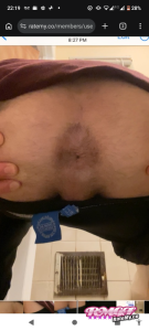 ass of Stuey75
