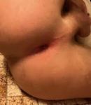 Wetwilly's Ass picture has the higest score