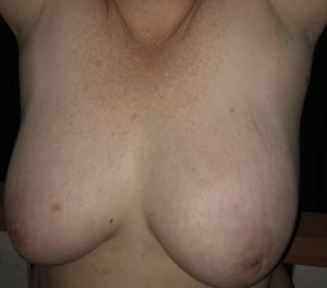 Titlover00's Boobs image