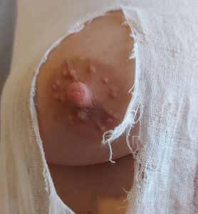 Peugeot100's Boobs image