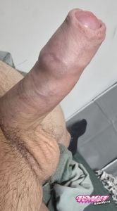 Galagon's Cock image
