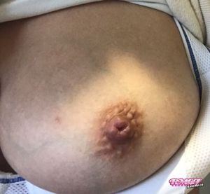 WifeyxHubby's Boobs image